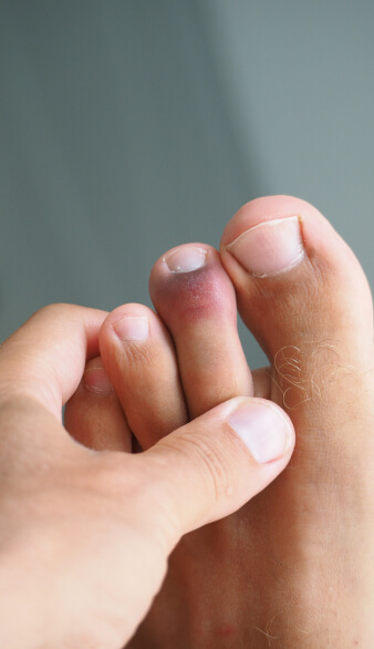 Checking feet for fungus